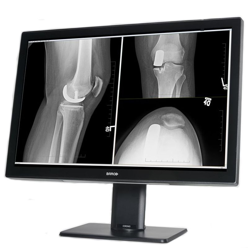Медицинский монитор Barco Coronis Fusion 4MP MDCC-4430
