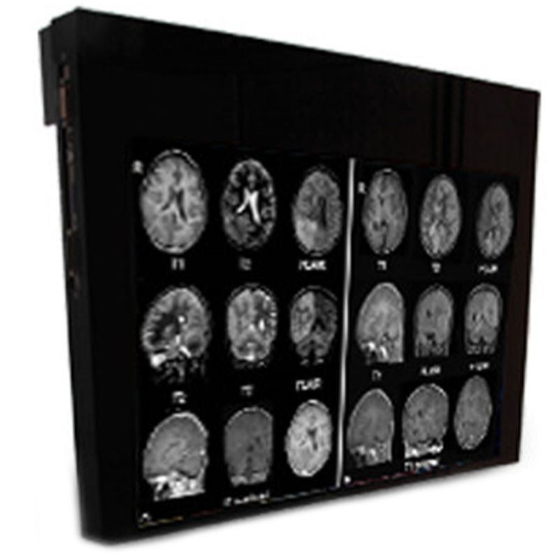 Медицинский монитор Double Black Imaging 24 MRSafe Display»
