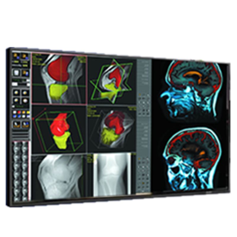 Медицинский монитор Double Black Imaging 42 Professional LCD»