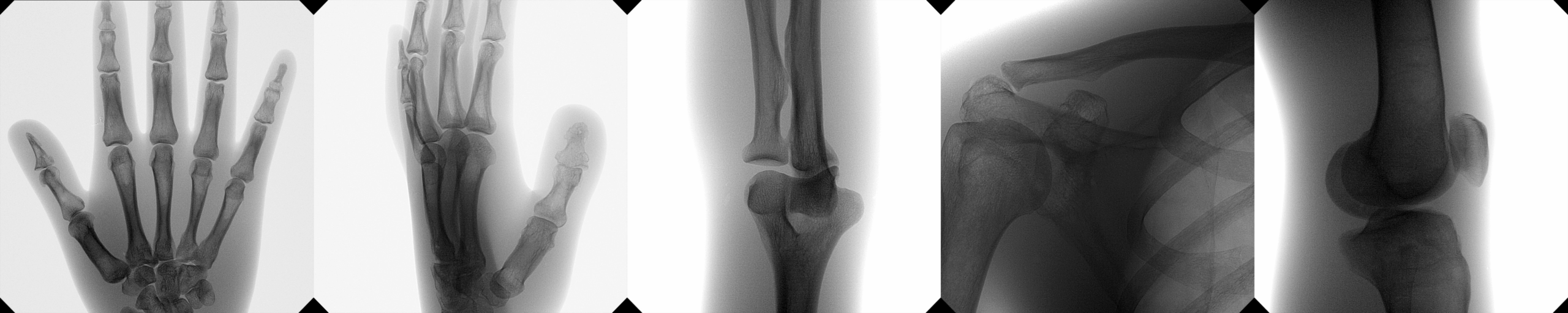 С-дуга Orthoscan TAU